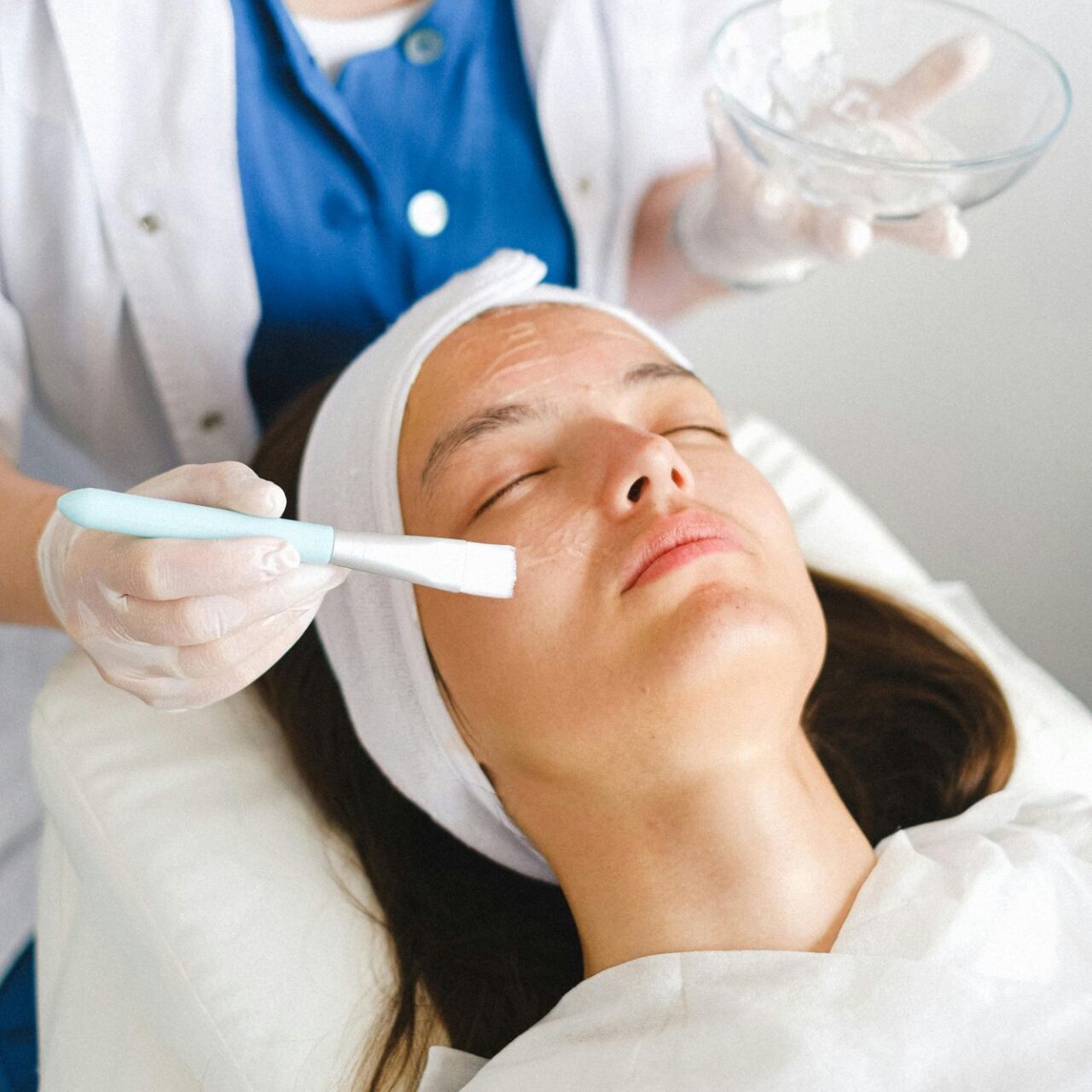cp-dental-chemical-peel