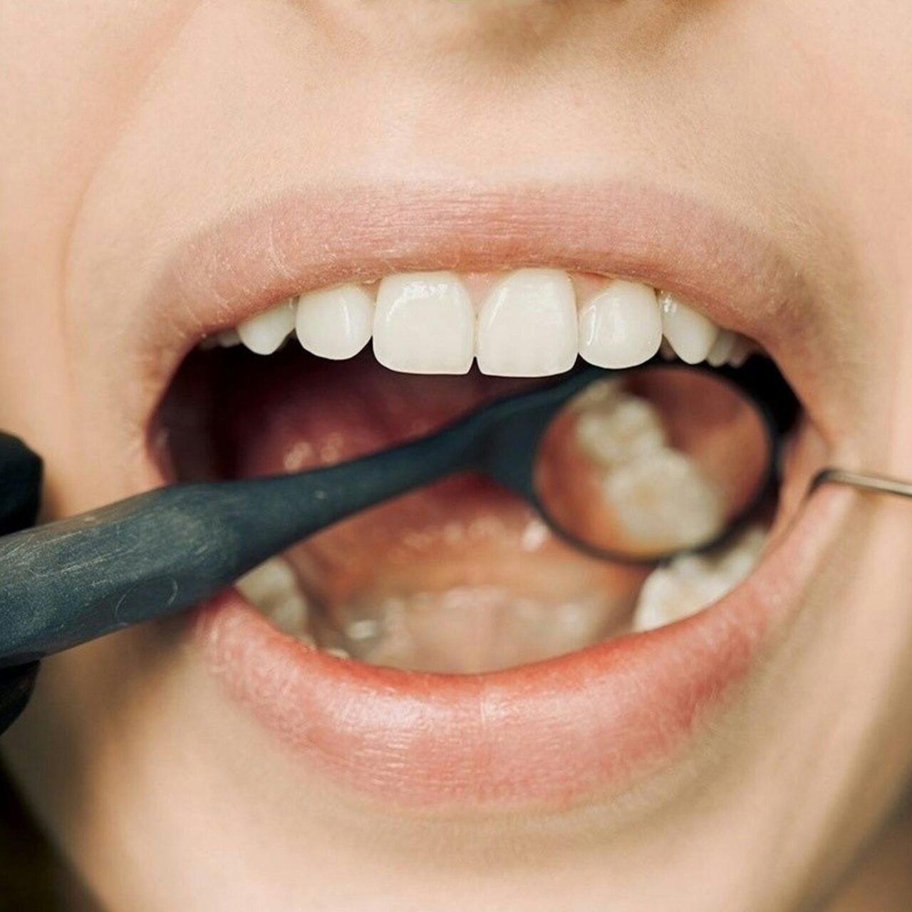 cp-dental-normal-checkup