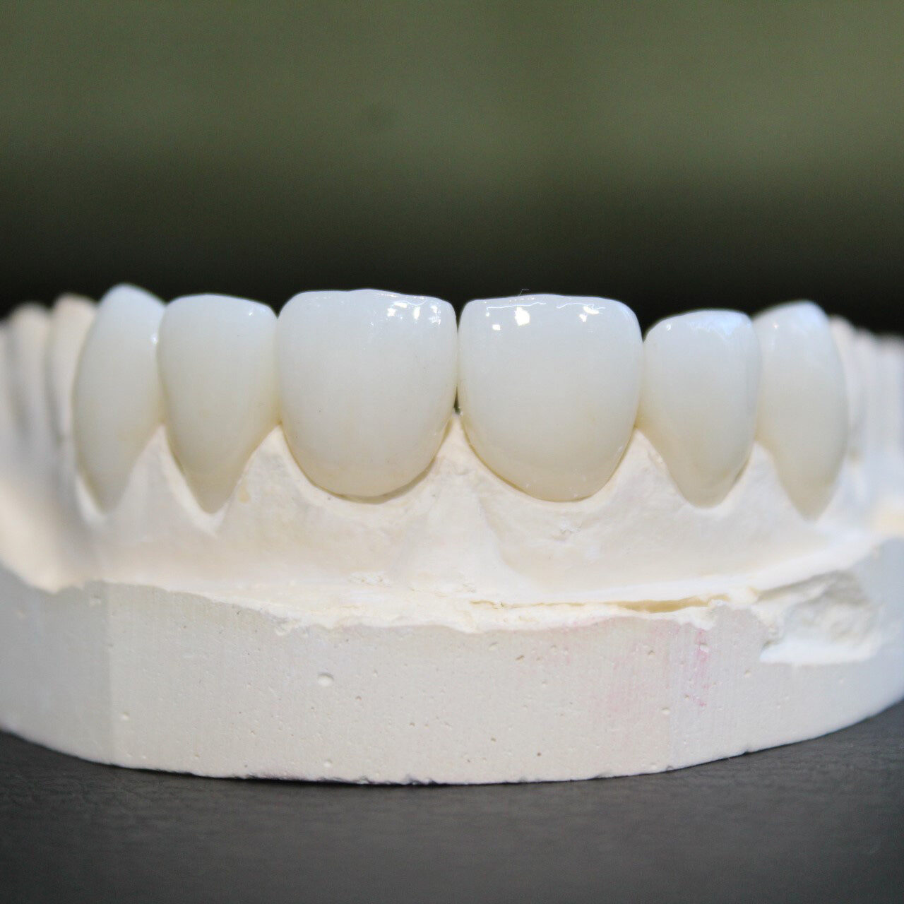 cpdental-patient-2